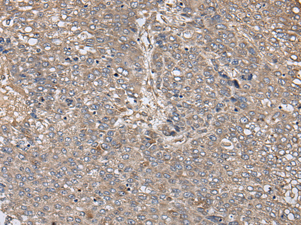 Rabbit Polyclonal Antibody to ZFP36