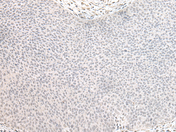 Rabbit Polyclonal Antibody to ZNF138