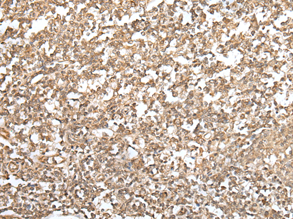 Rabbit Polyclonal Antibody to ZNF19