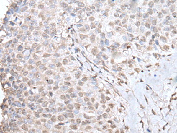 Rabbit Polyclonal Antibody to ZNF207