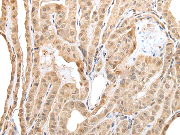 Rabbit Polyclonal Antibody to ZNF202