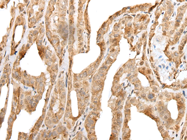 Rabbit Polyclonal Antibody to ZNF213