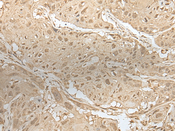 Rabbit Polyclonal Antibody to ZBTB18