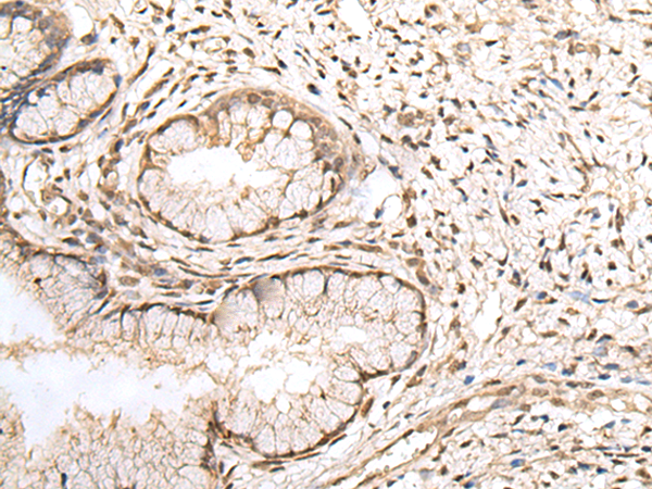 Rabbit Polyclonal Antibody to ZNF266