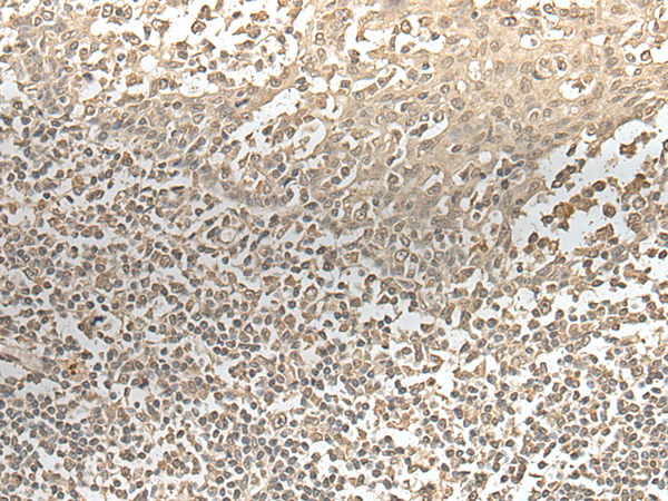 Rabbit Polyclonal Antibody to ZNF274
