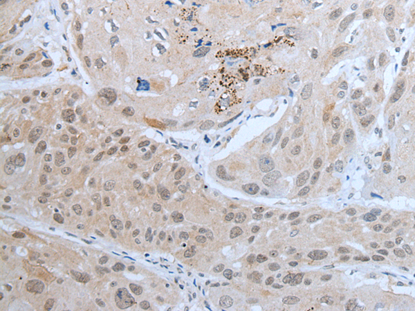 Rabbit Polyclonal Antibody to ZNF277