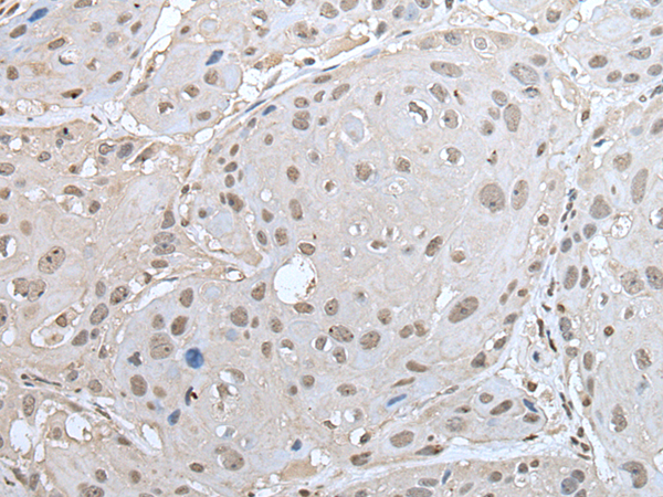 Rabbit Polyclonal Antibody to ZNF302