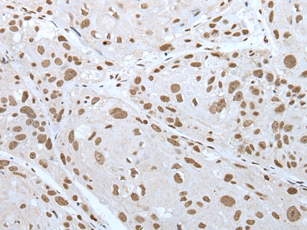Rabbit Polyclonal Antibody to ZNF300
