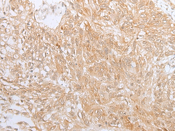 Rabbit Polyclonal Antibody to ZNF34