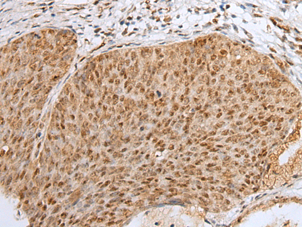 Rabbit Polyclonal Antibody to ZNF354A