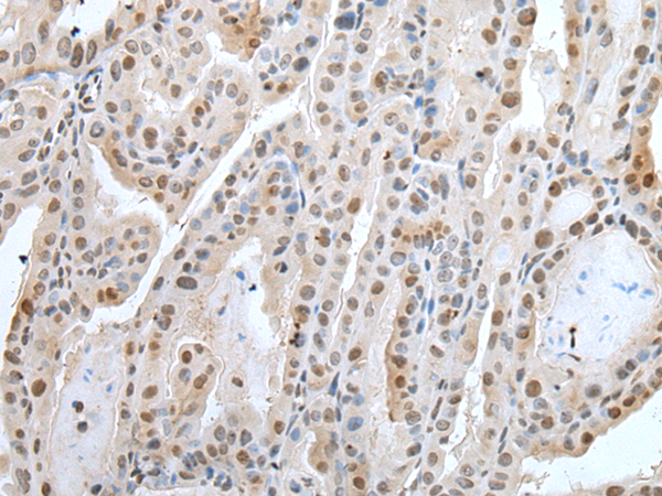 Rabbit Polyclonal Antibody to ZNF37A
