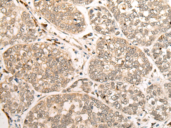 Rabbit Polyclonal Antibody to ZNF41