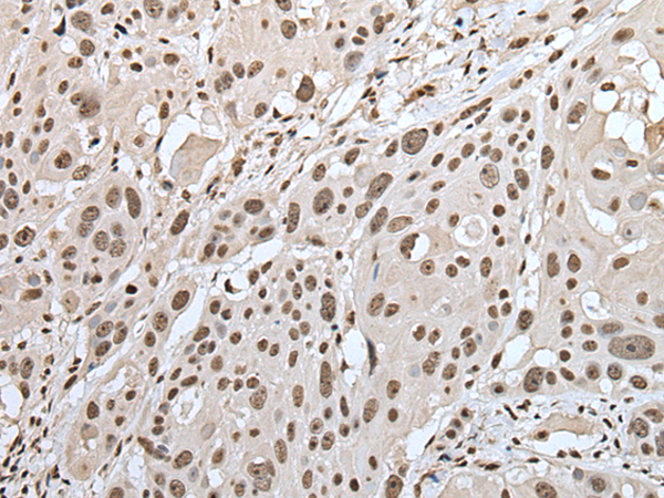 Rabbit Polyclonal Antibody to ZNF43