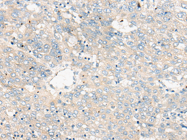 Rabbit Polyclonal Antibody to ZNF449