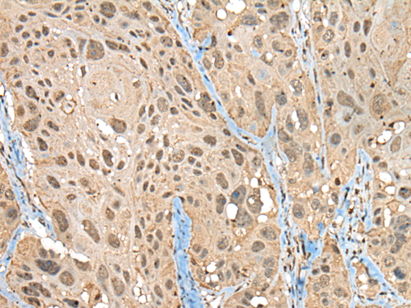 Rabbit Polyclonal Antibody to ZNF468