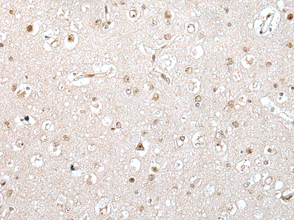 Rabbit Polyclonal Antibody to ZNF483