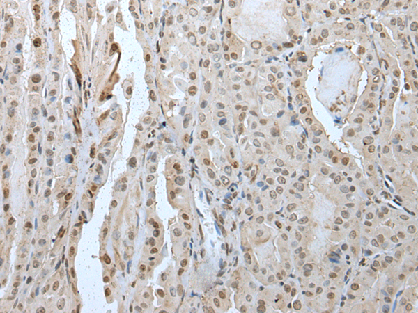 Rabbit Polyclonal Antibody to ZNF512