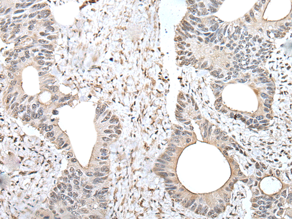 Rabbit Polyclonal Antibody to ZNF83