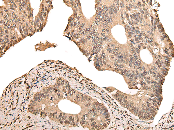 Rabbit Polyclonal Antibody to ZSCAN12