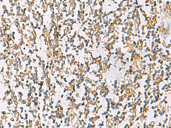 Rabbit Polyclonal Antibody to ZPBP2
