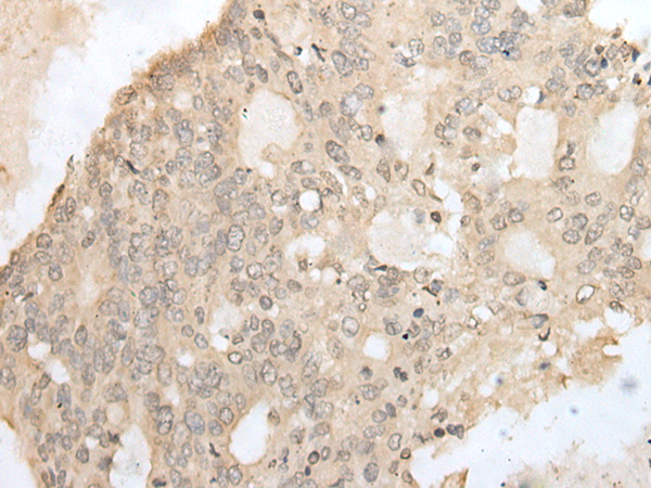 Rabbit Polyclonal Antibody to ZZZ3