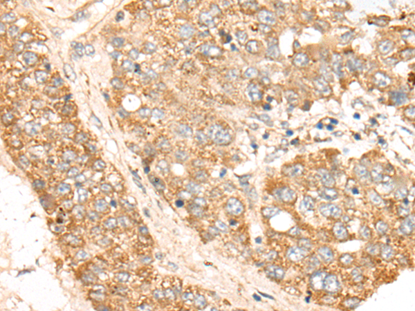 Rabbit Polyclonal Antibody to TDGF1