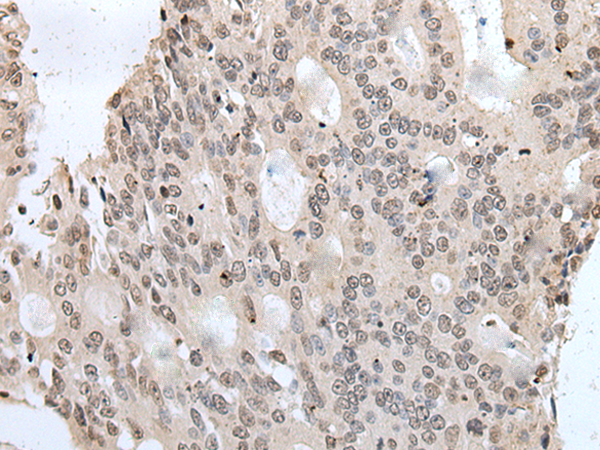 Rabbit Polyclonal Antibody to YPEL1