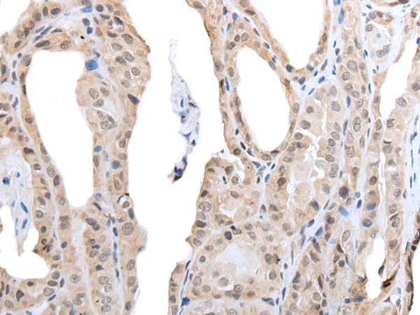 Rabbit Polyclonal Antibody to YPEL3