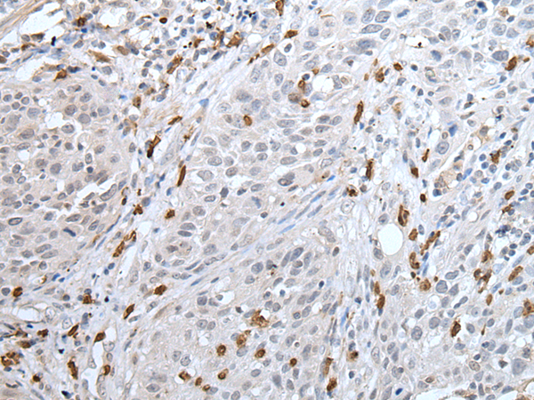 Rabbit Polyclonal Antibody to YPEL2