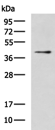 Rabbit Polyclonal Antibody to XPA