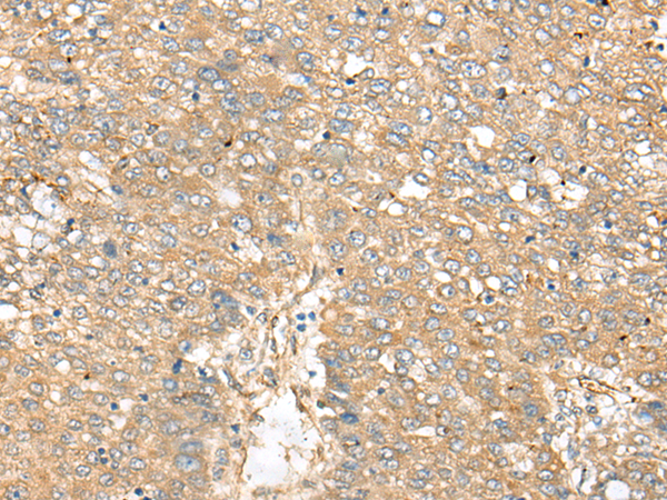 Rabbit Polyclonal Antibody to XPO6