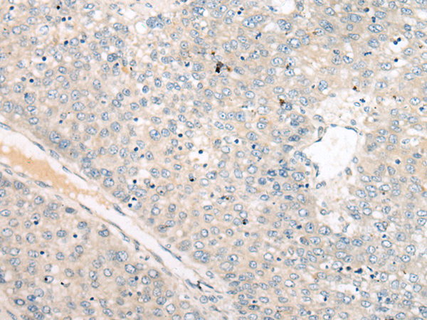 Rabbit Polyclonal Antibody to WBP1