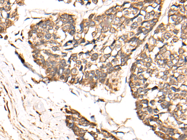 Rabbit Polyclonal Antibody to TCEAL9