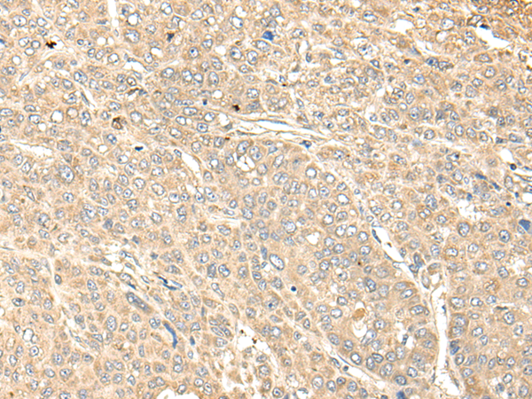 Rabbit Polyclonal Antibody to WDFY4