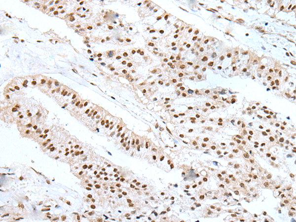 Rabbit Polyclonal Antibody to WTAP