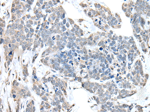 Rabbit Polyclonal Antibody to ANKRD27