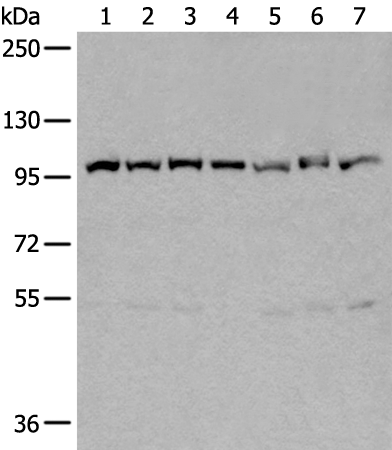 Rabbit Polyclonal Antibody to VCP