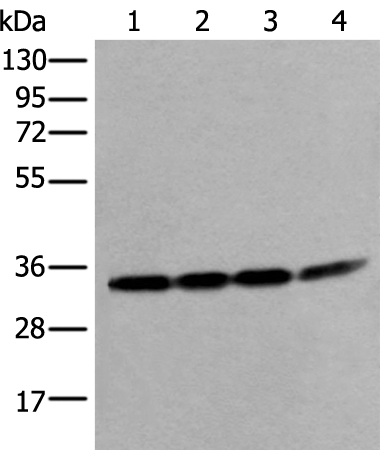 Rabbit Polyclonal Antibody to VDAC1