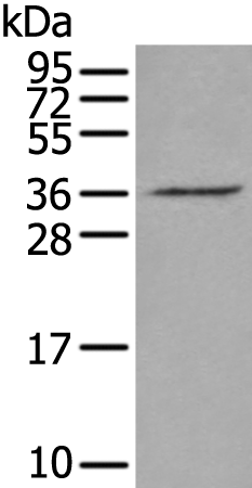 Rabbit Polyclonal Antibody to VGLL2