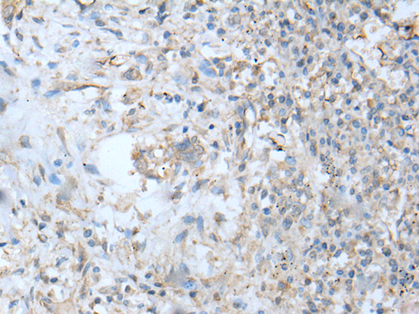 Rabbit Polyclonal Antibody to VILL