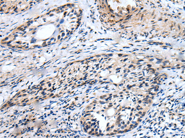 Rabbit Polyclonal Antibody to VPREB3