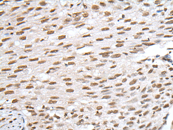 Rabbit Polyclonal Antibody to VSX1