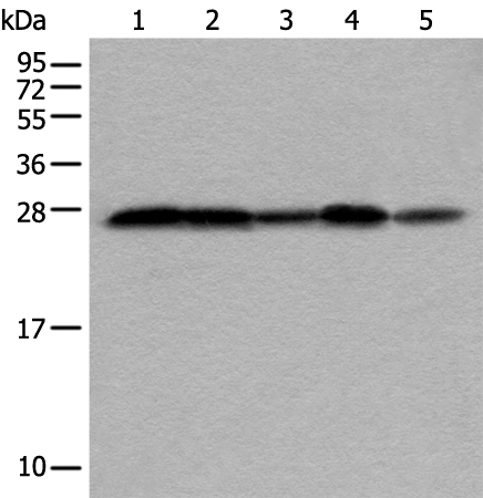 Rabbit Polyclonal Antibody to VTI1A