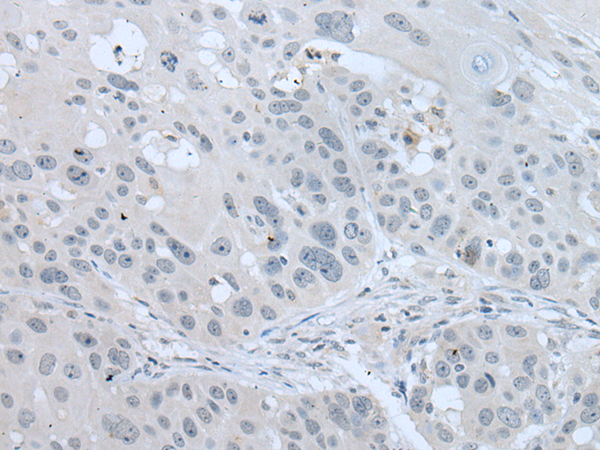 Rabbit Polyclonal Antibody to VWA2