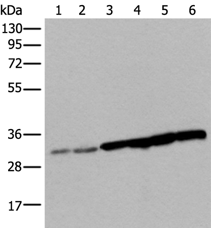 Rabbit Polyclonal Antibody to SNRPA