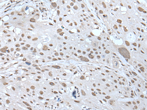 Rabbit Polyclonal Antibody to U2AF2