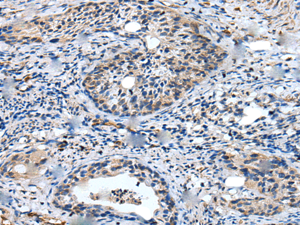Rabbit Polyclonal Antibody to UBA6