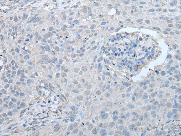 Rabbit Polyclonal Antibody to UBASH3A
