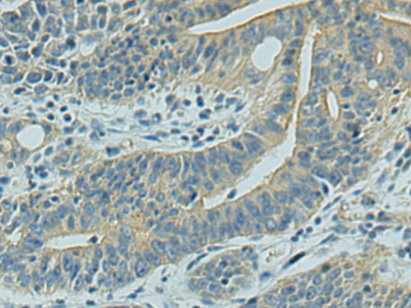 Rabbit Polyclonal Antibody to UBE2R2