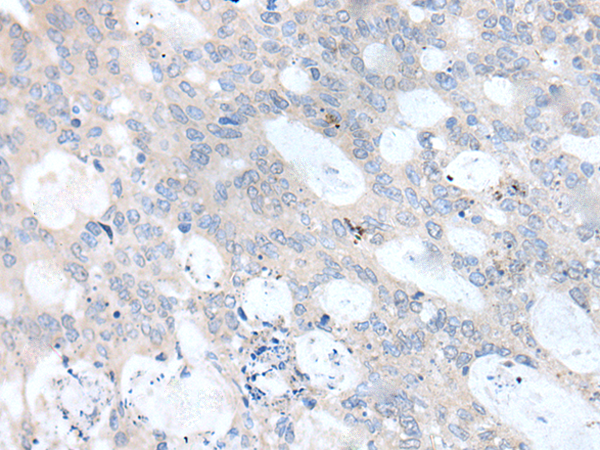 Rabbit Polyclonal Antibody to UBE2Q2